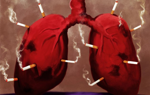 Cigarette-Smoking-Is-The-Main-Cause-Of-Lung-Cancer